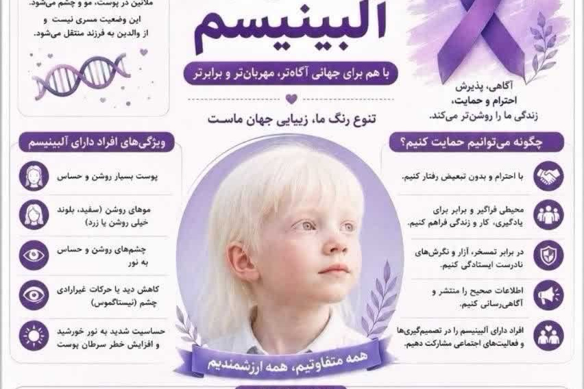 روز جهانی آگاهی از آلبینیسم