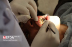 اجرای طرح سفیران سلامت با ارائه خدمات دندانپزشکی در روستاهای اردبیل