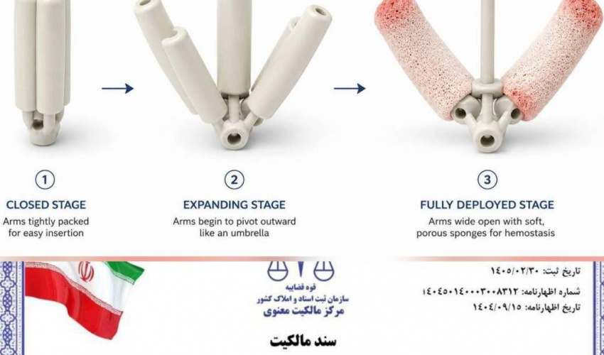 ثبت اختراع تامپون بینی دارویی خودمتورم‌شونده توسط اعضای کادر درمان اردبیل